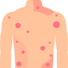 Dermatology